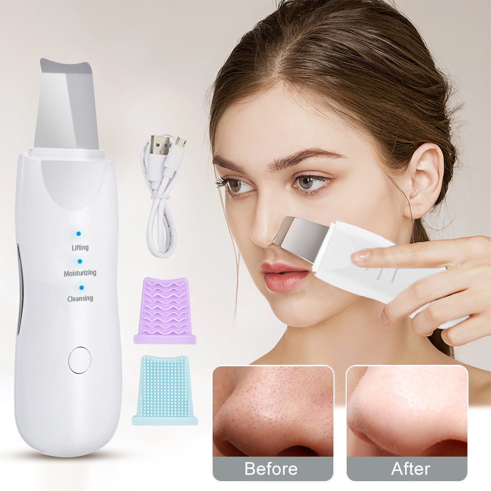 Ultrasonic Facial Skin Scrubber – Deep Cleansing & Blackhead Remover