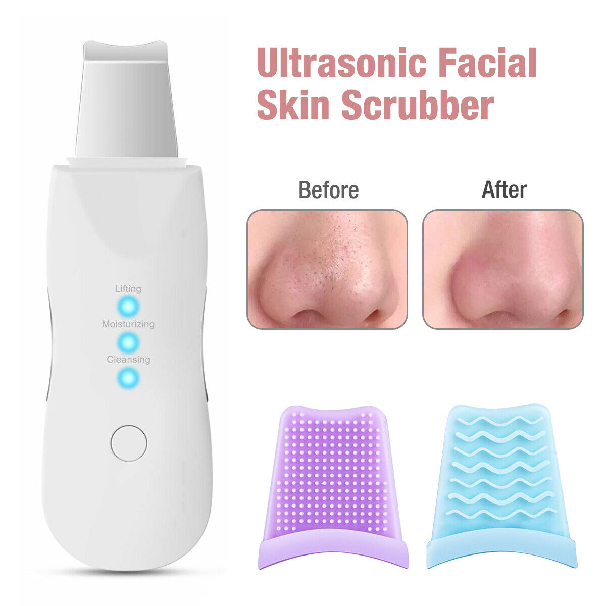 Ultrasonic Facial Skin Scrubber – Deep Cleansing & Blackhead Remover