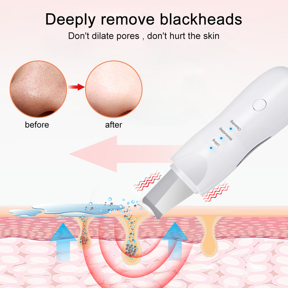 Ultrasonic Facial Skin Scrubber – Deep Cleansing & Blackhead Remover