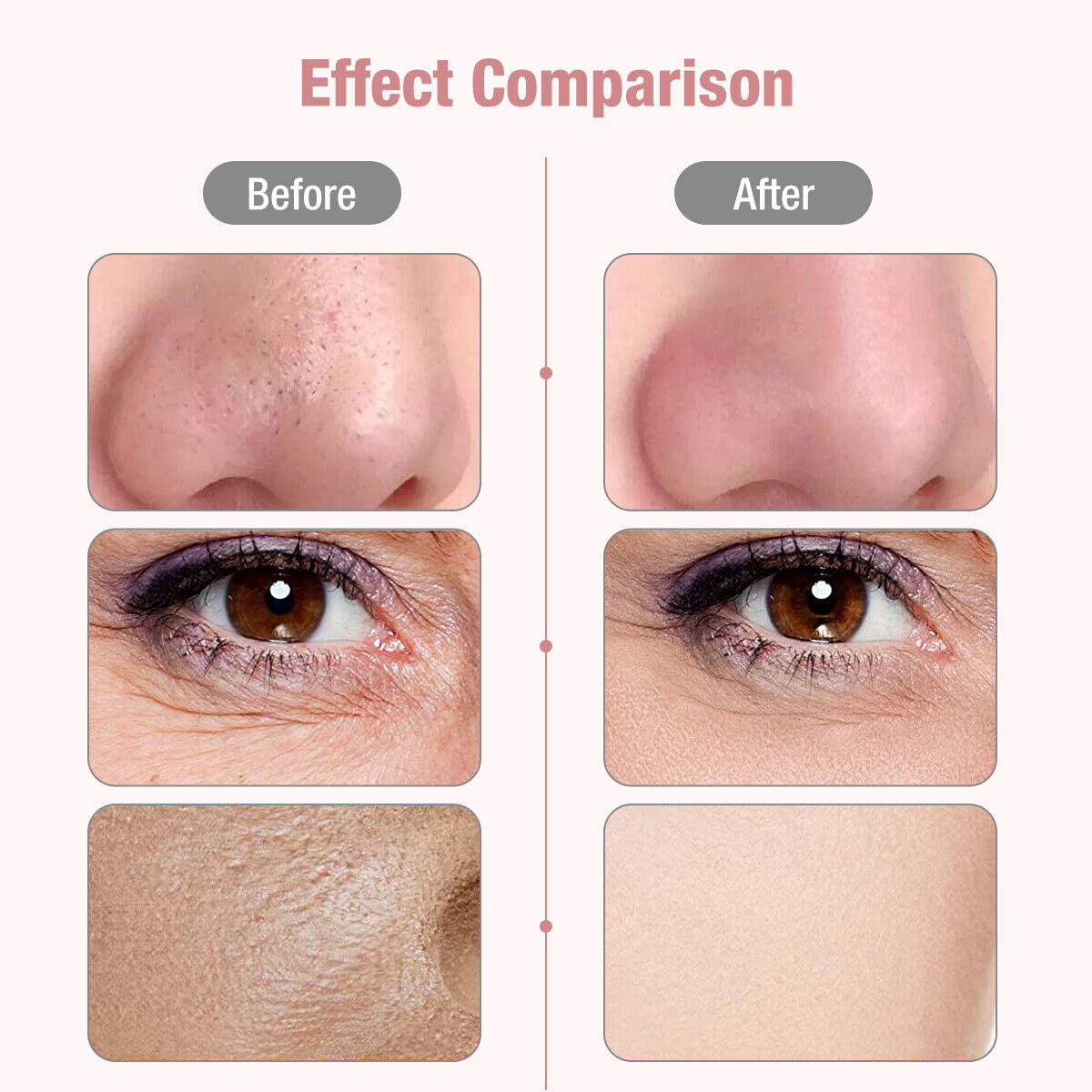 Ultrasonic Facial Skin Scrubber – Deep Cleansing & Blackhead Remover